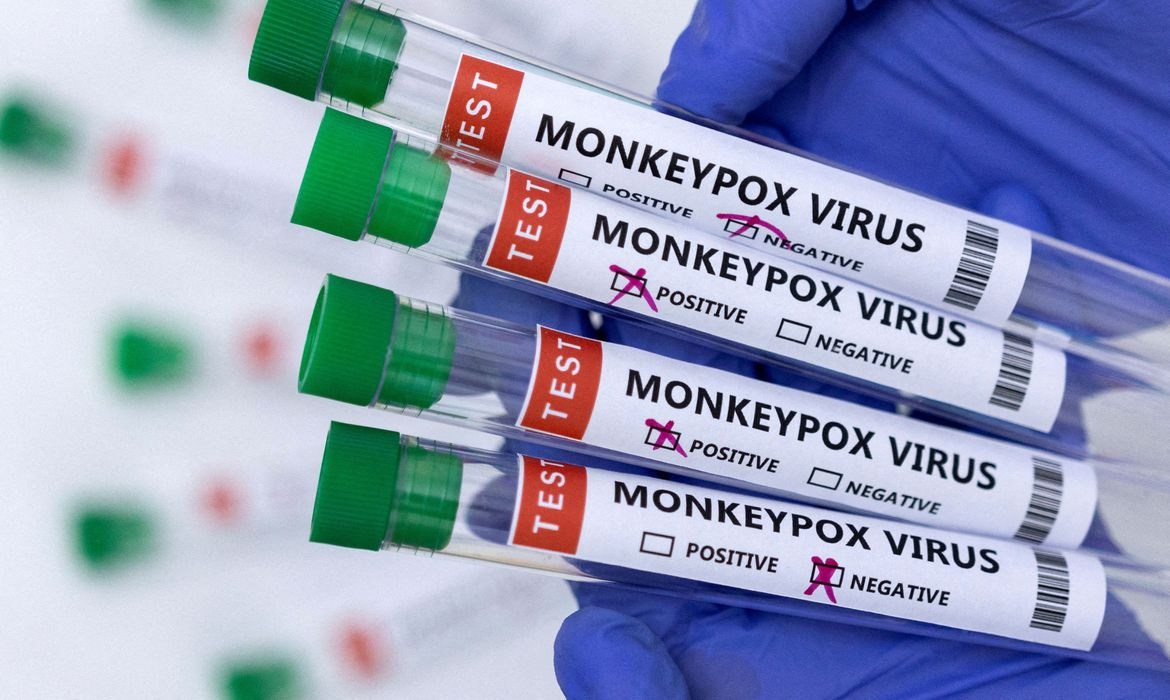 Saúde institui protocolo de atendimento para os casos de monkeypox